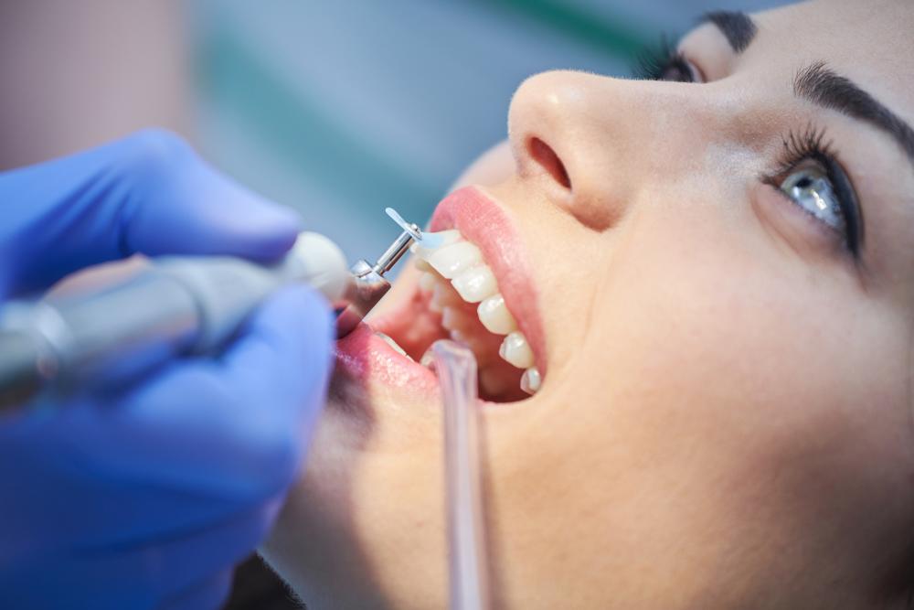 Zahnarzt Siegburg Zahnreinigung und Prophylaxe
